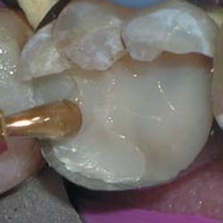 Core Paste